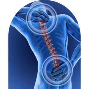 Xray of Osteoporosis of the spine